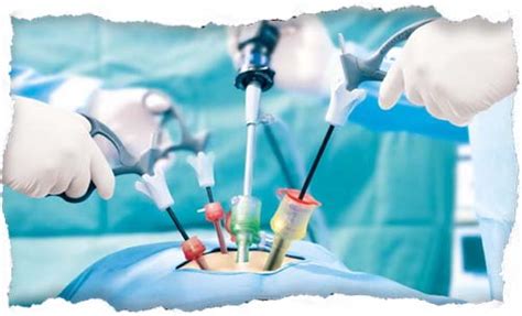 medical city don antonio|Department of Surgery / Minimal Access Surgery .